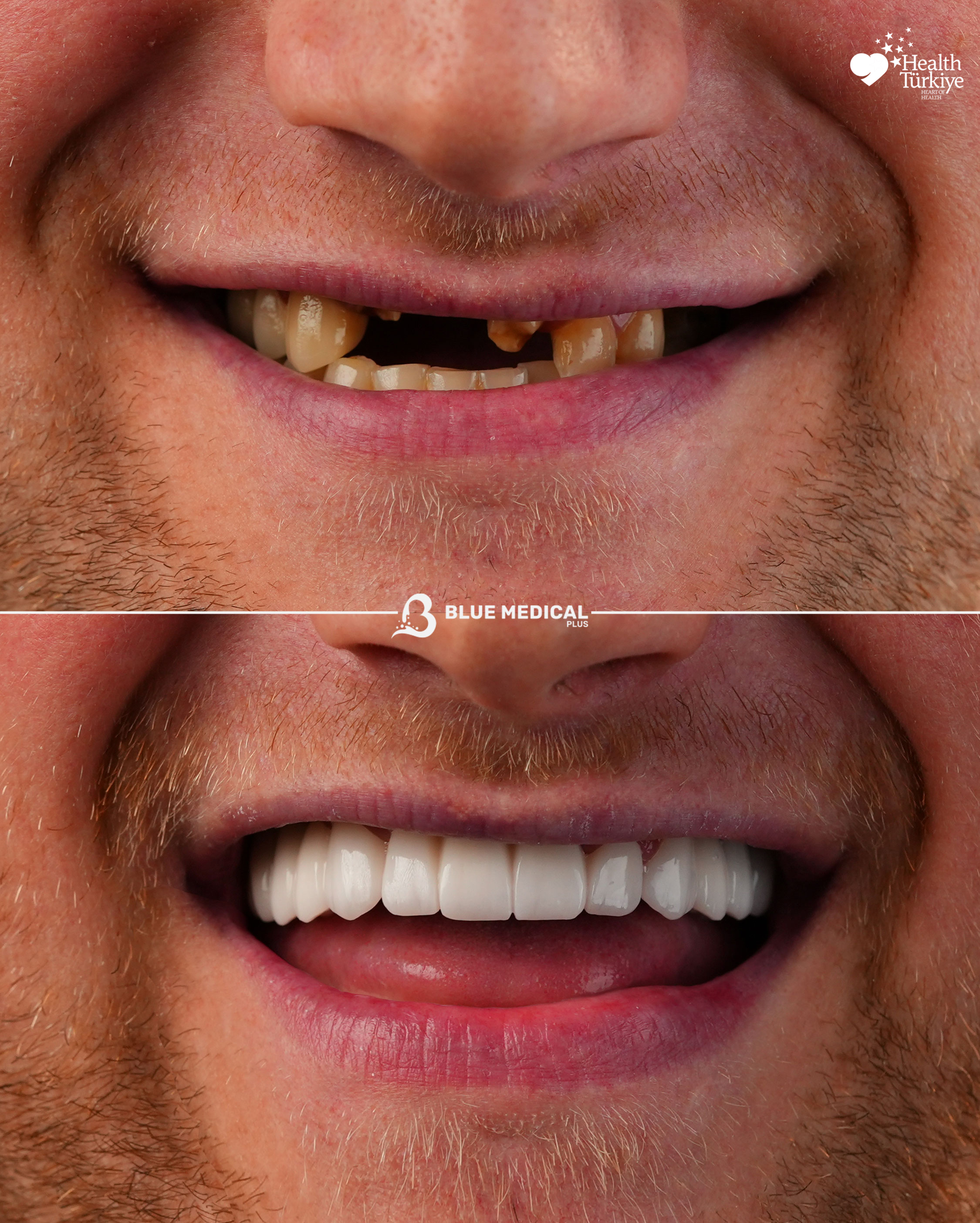 Before & After