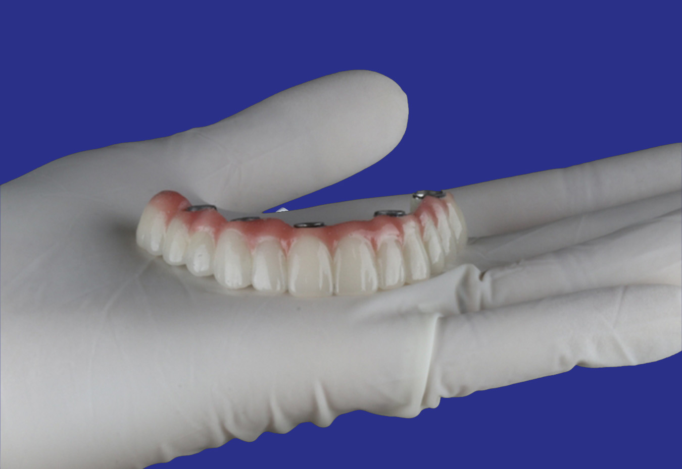 Zirconium + Hybrid